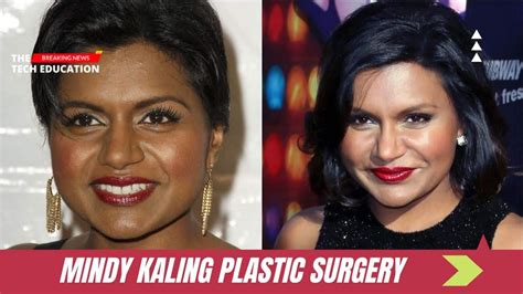 mindy kaling plastic surgery|Mindy Kaling’s Transformative Journey: Plastic Surgery ...